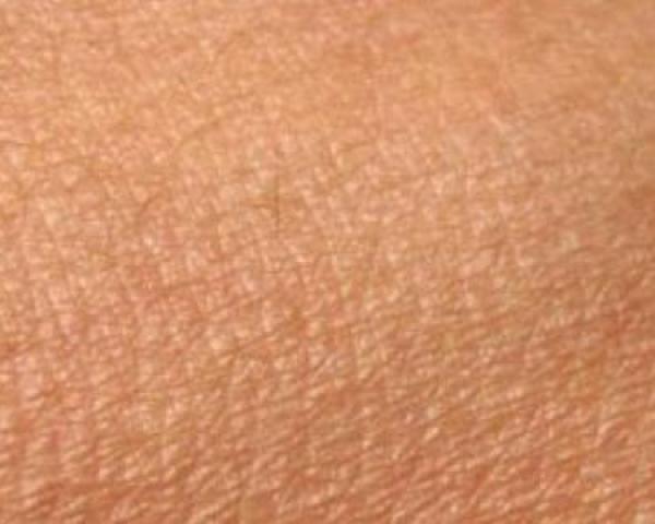 تخلصي من جفاف البشرة بهذه الطريقة السهلة